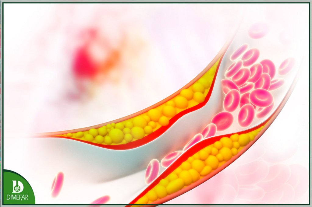 El colesterol elevado, la tercera enfermedad más frecuente en España
