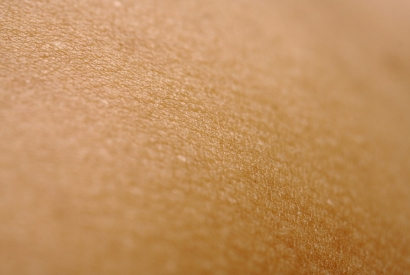 Cómo tratar la sequedad de piel y mucosas durante la menopausia de forma eficaz